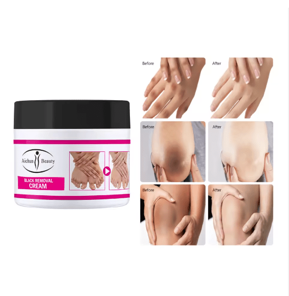 كريم Aichun Beauty للعناية بمظهر المناطق الداكنة للكوعين والركبتين