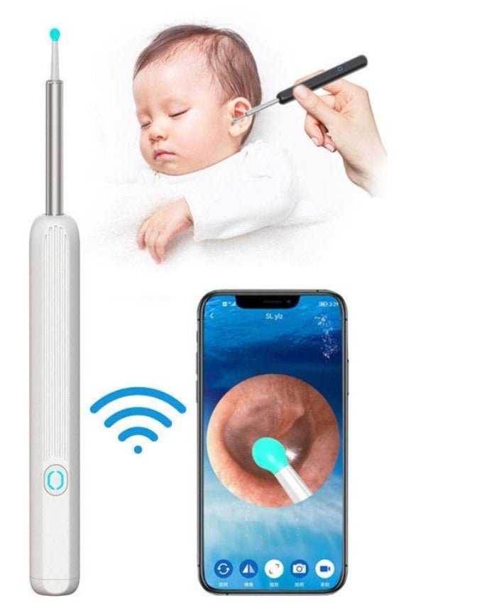 جهاز تنظيف الأذن بكاميرا HD واتصال واي فاي