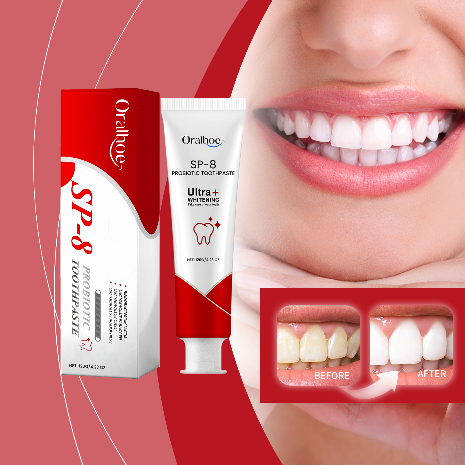 معجون أسنان بروبيوتيك Oralhoe SP-8 بحجم 120 جم